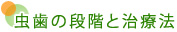 虫歯の段階と治療法